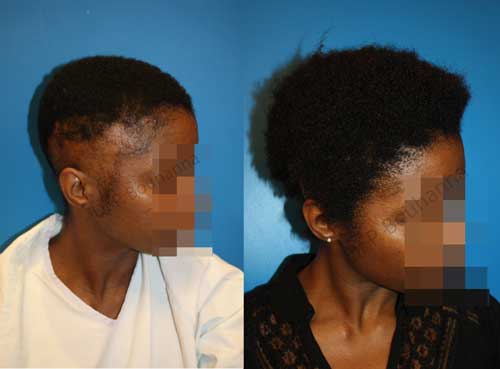 Élixir de Croissance : Comment Stimuler la Pousse des Cheveux Crépus - 7 Conseils d'Experts - Kymia Paris